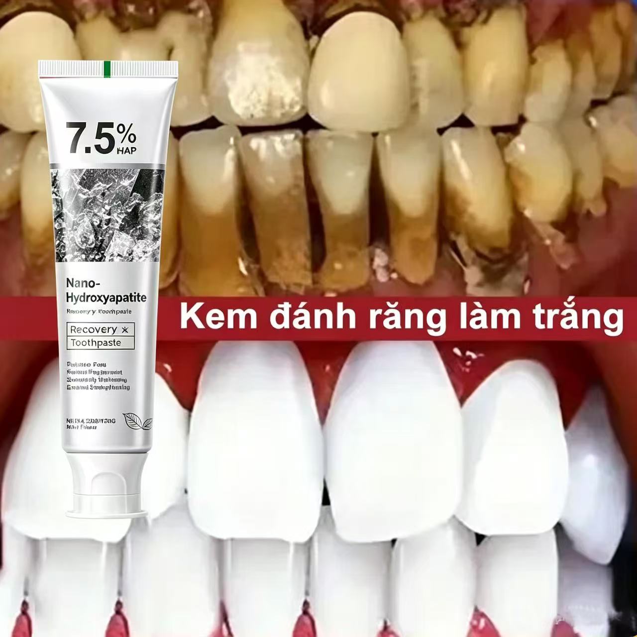 Teeth Whitening Best - Dentifrice blanchissant probiotique à 7,5 %