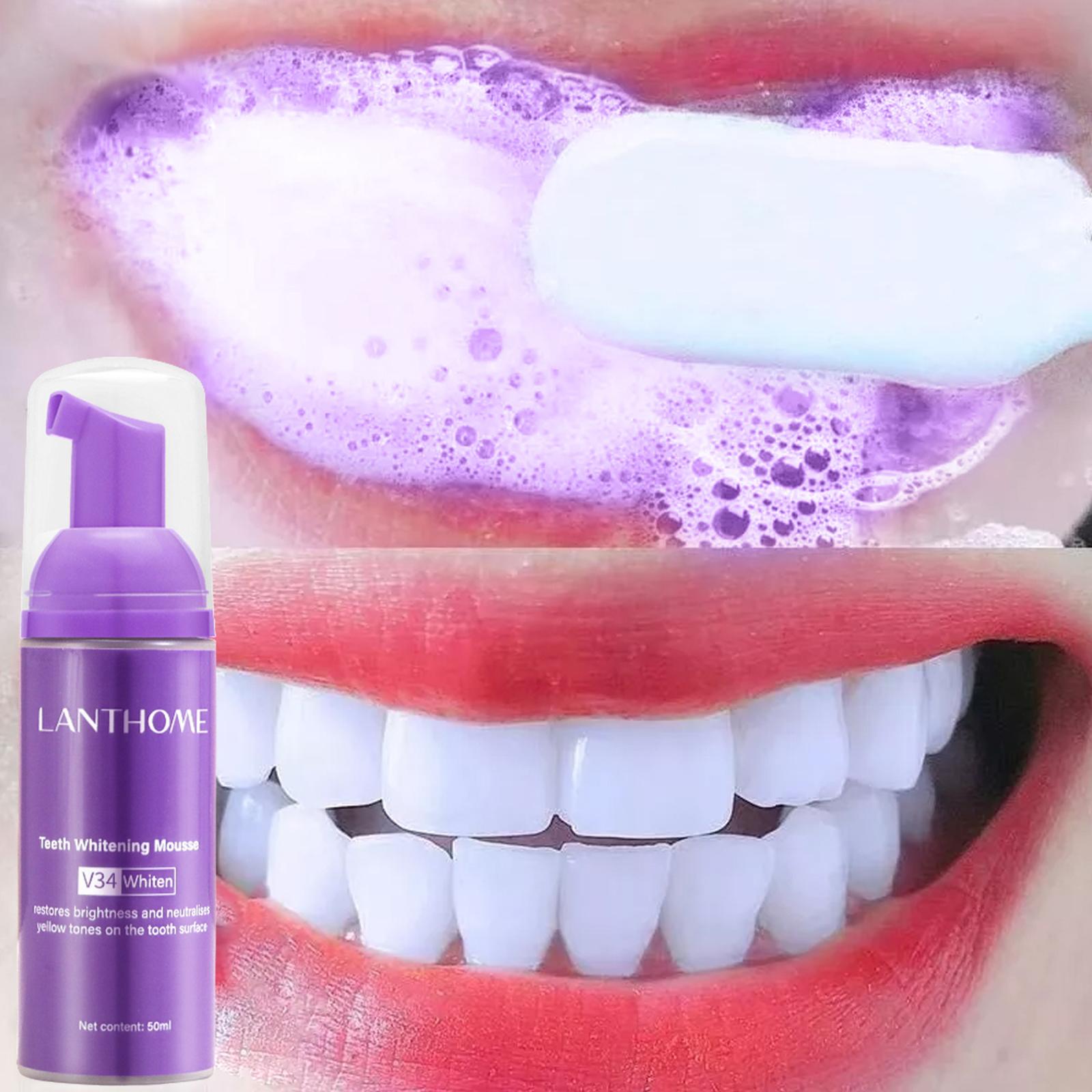 V34 Mousse nettoyage des dents - Teeth Whitening Crest avis et prix