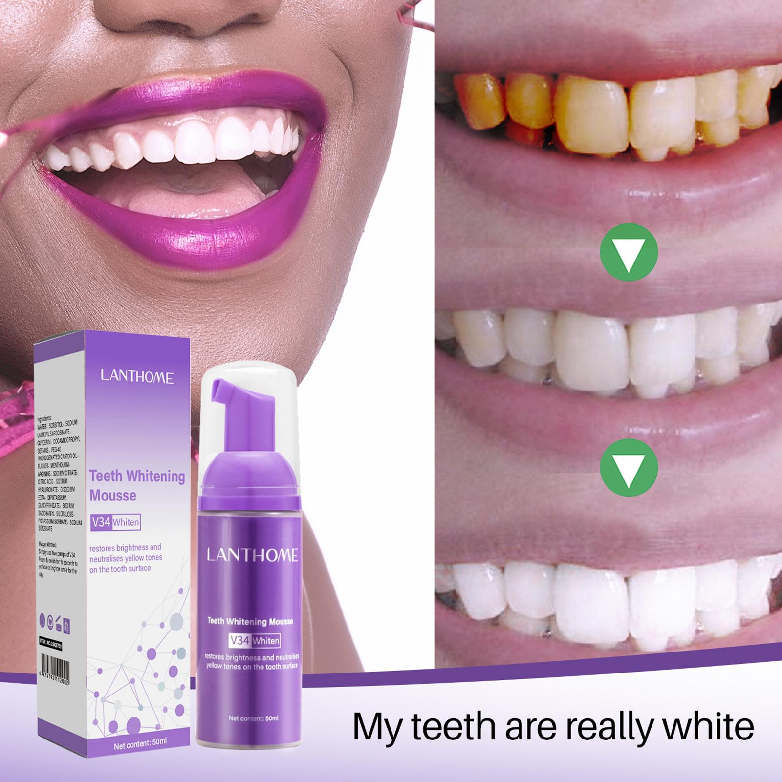 V34 Mousse nettoyage des dents - Teeth Whitening Crest avis et prix