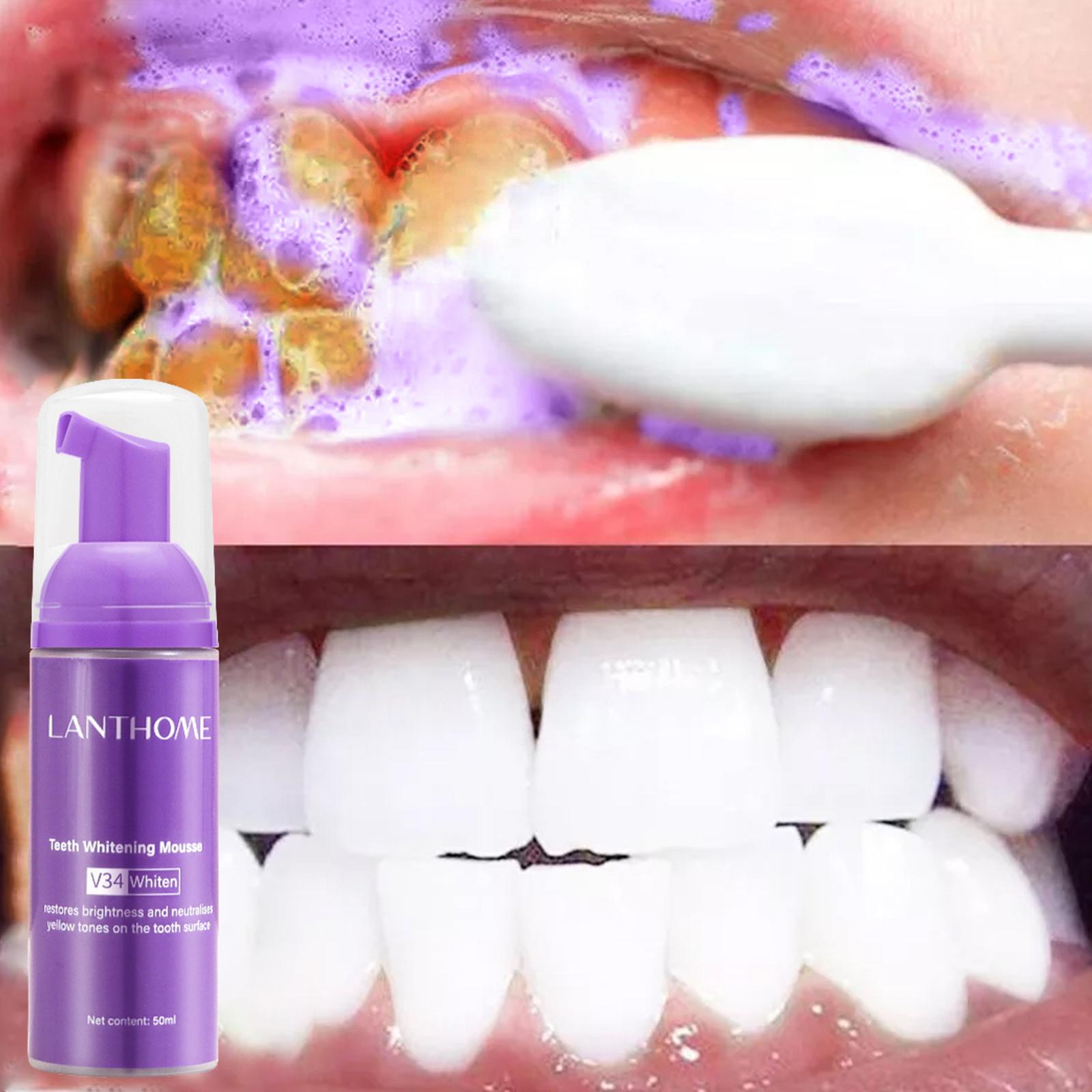 V34 Mousse nettoyage des dents - Teeth Whitening Crest avis et prix