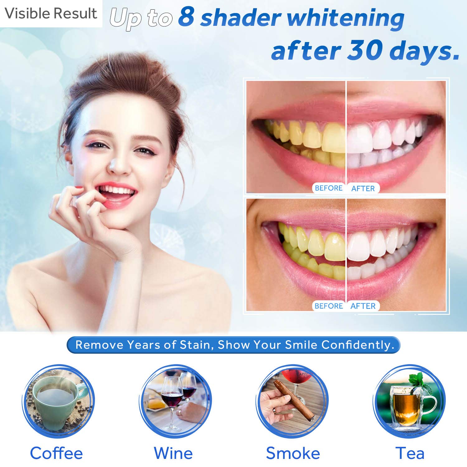Gel de blanchiment des dents r - Teeth Whitening Shade Guide avis et prix