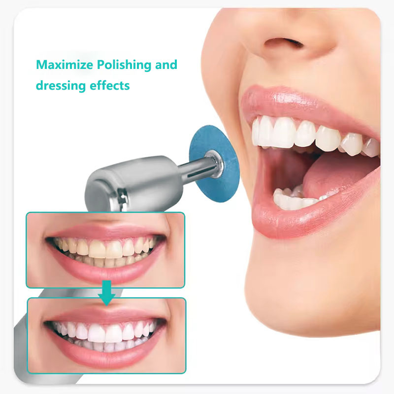 Disques de polissage dentaire, - Teeth Whitening Uk avis et prix