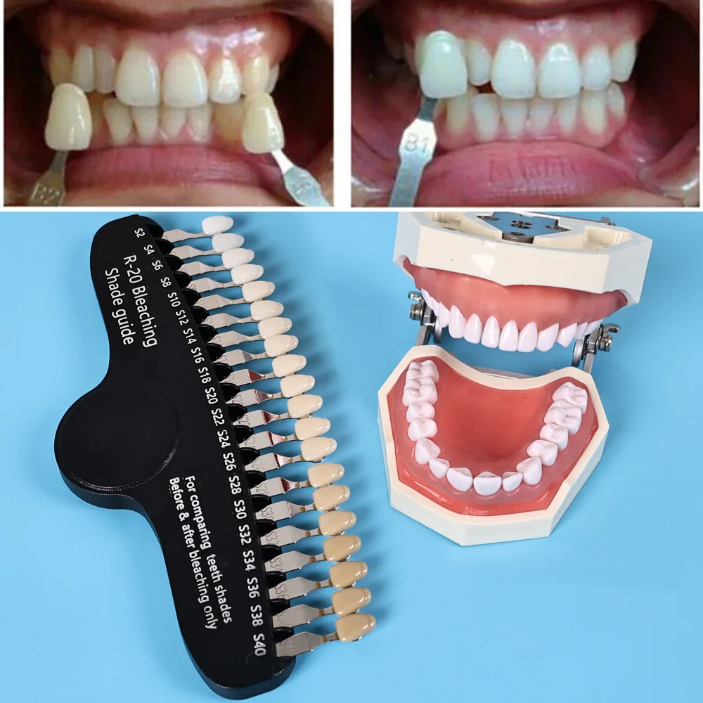 ELIJAH R-20 Guide d'ombre de b - Teeth Whitening Shade Guide avis et prix