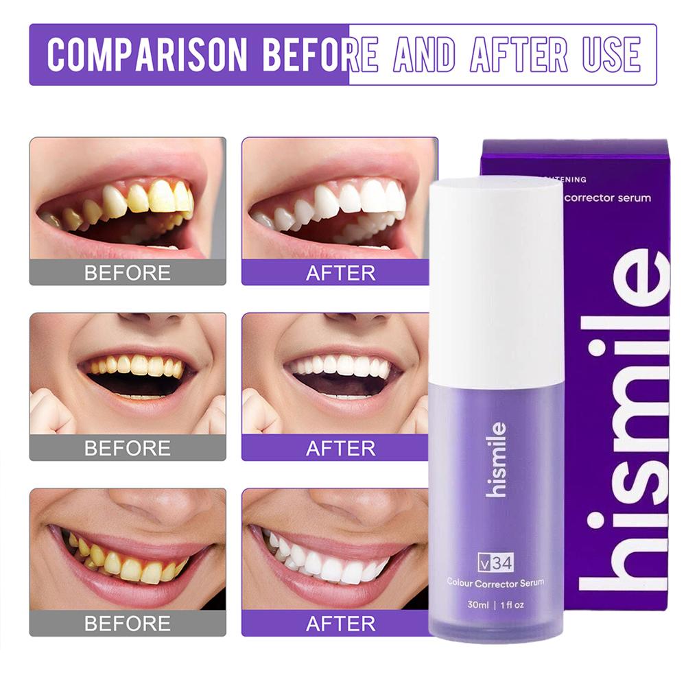 30ml Hismile V34 Mousse blanch - Teeth Whitening Crest avis et prix