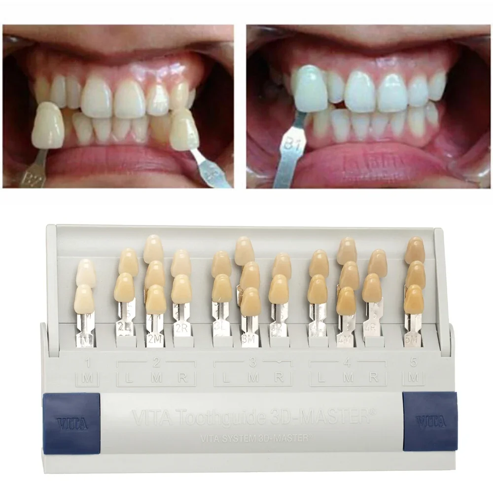 Vita 3D Master – Guide d'ombre - Teeth Whitening Shade Guide avis et prix